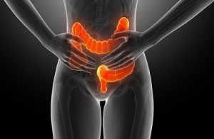 Bowel Cancer Risk and Obesity