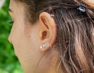 Do Weight Loss Earrings Work?